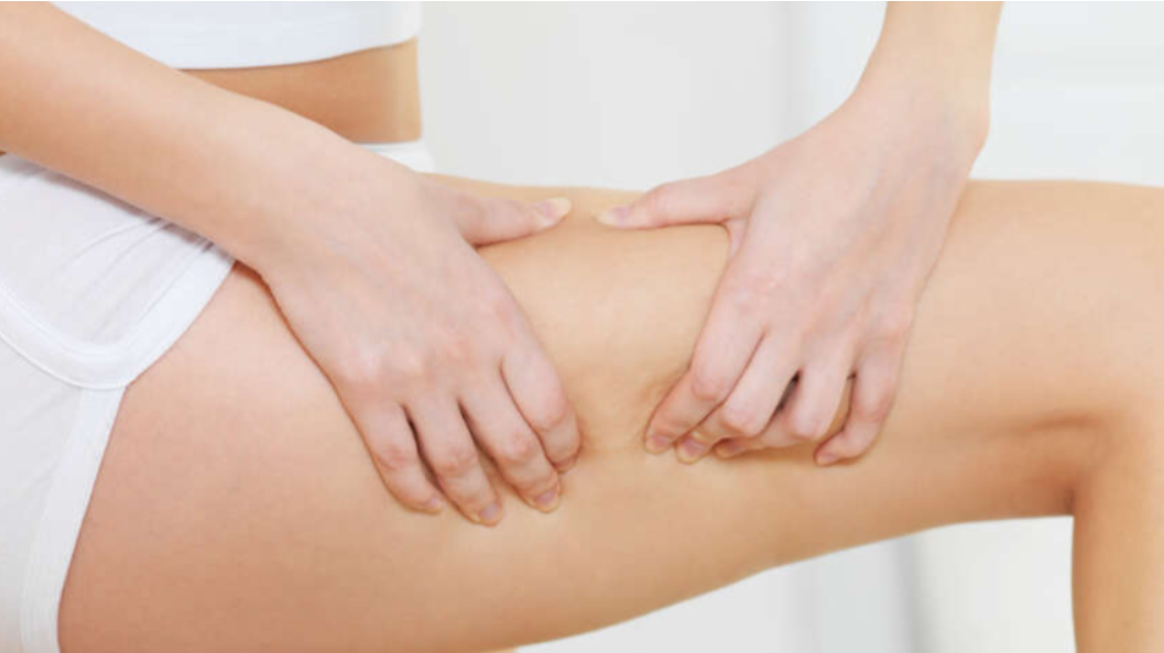 5 dicas para lutar contra a celulite