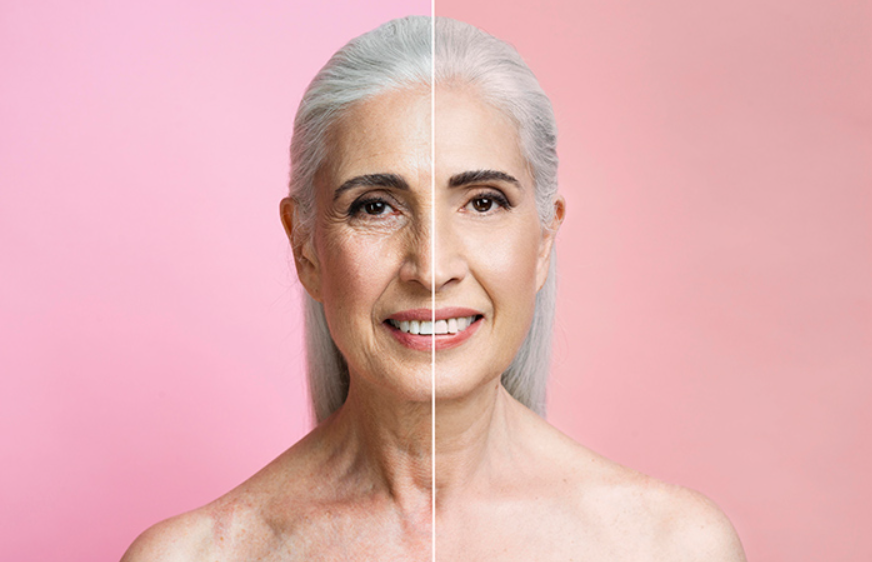 Colágeno Verisol® x colágeno hidrolisado: qual é o melhor?